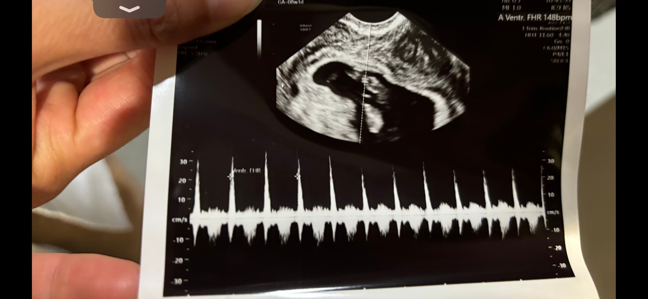 My Fertility Journey, photo 1 of 1