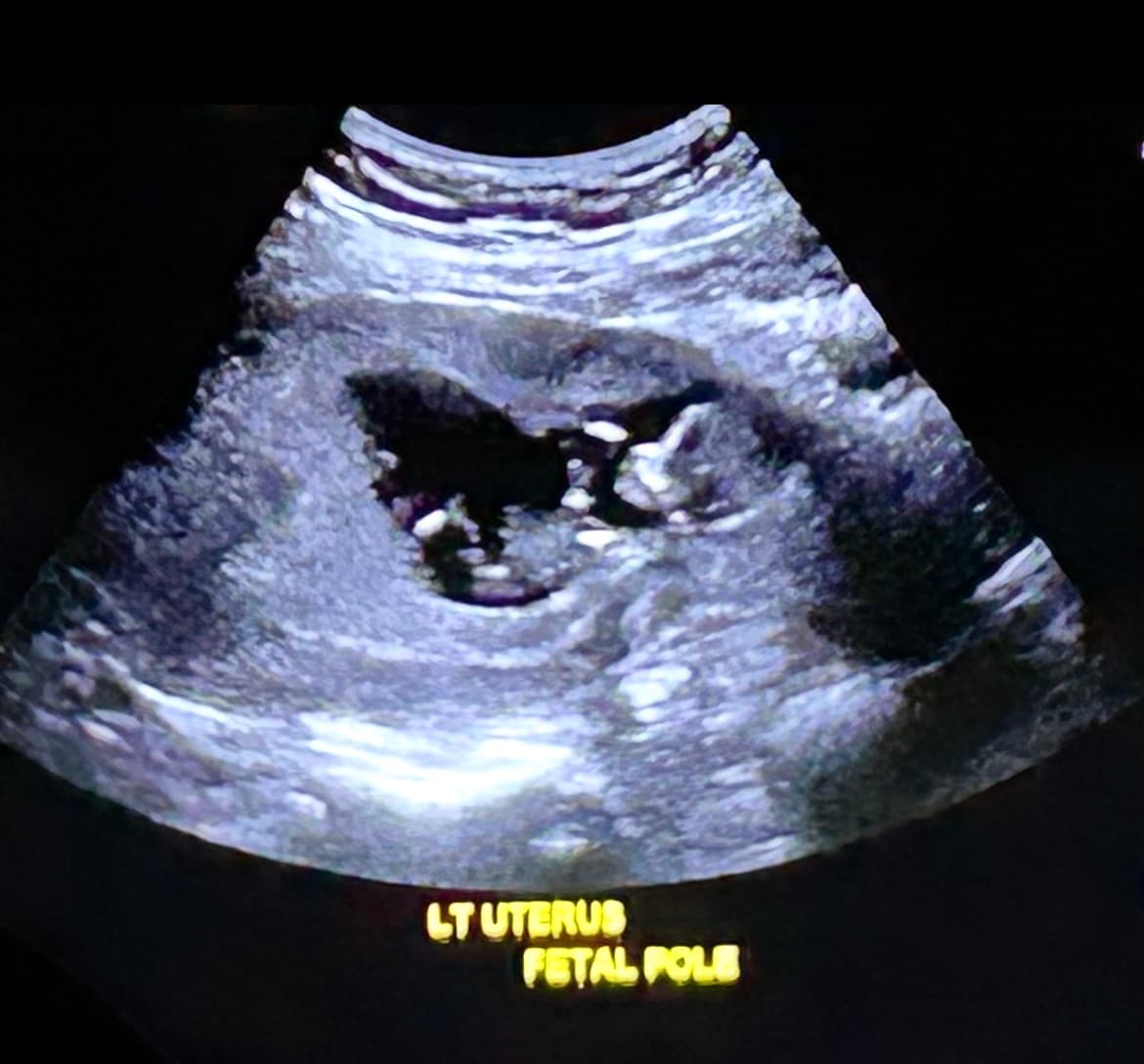 Kristin & Bryant's IVF Journey, photo 1 of 1