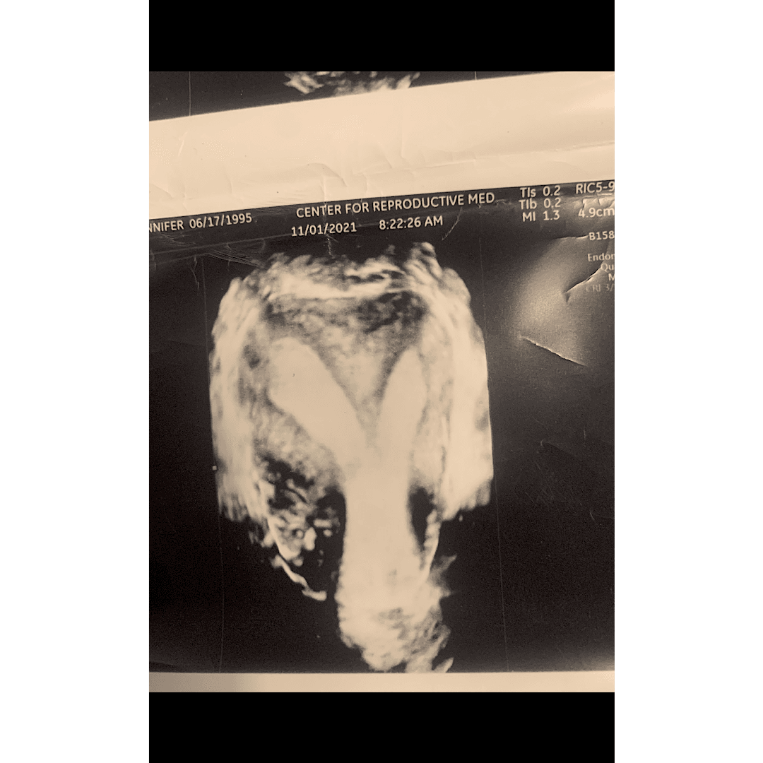 Jennifer’s Uterus, photo 1 of 2