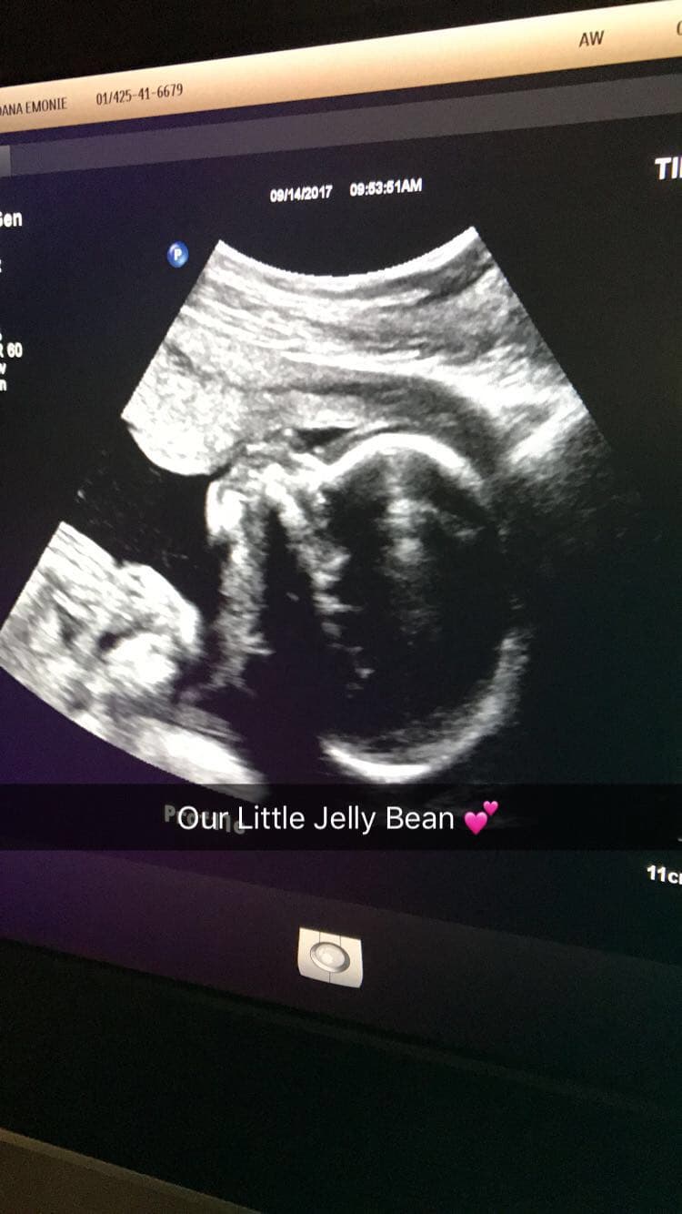 IVF single mother!, photo 1 of 1