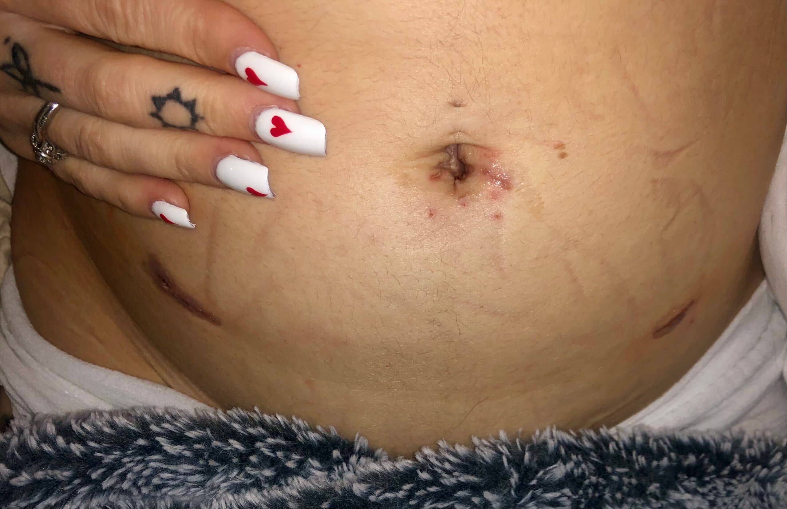 Help us start a family via IVF, photo 1 of 1