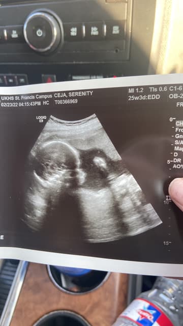 Help Jessalyn, photo 1 of 1