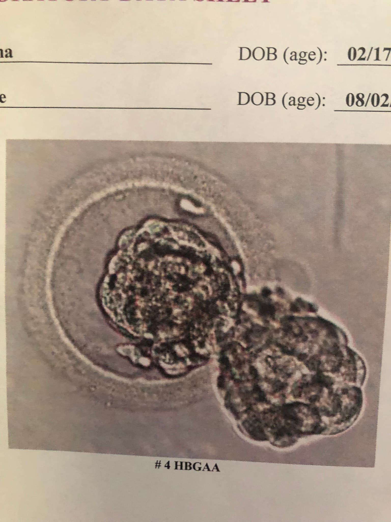 Angie’s Frozen embryos, photo 1 of 1