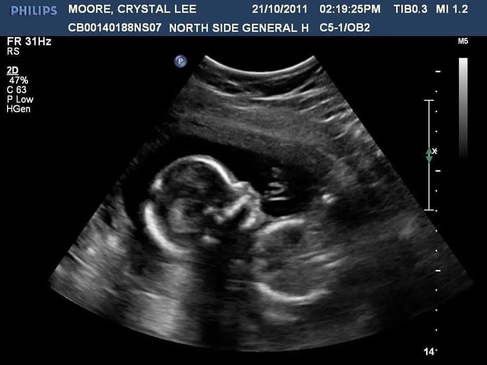 Help me have my miracle, photo 1 of 1
