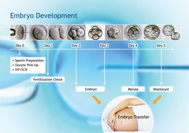 IVF procedure, photo 1 of 1