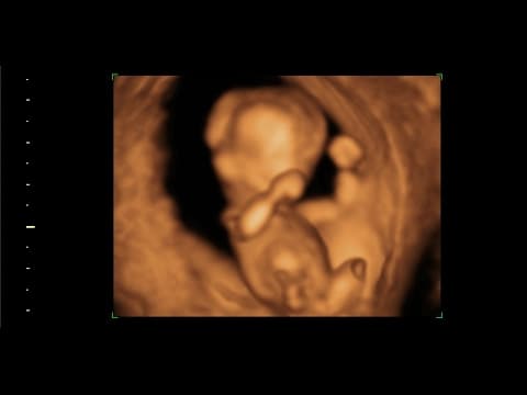 Fertility struggle, photo 1 of 1