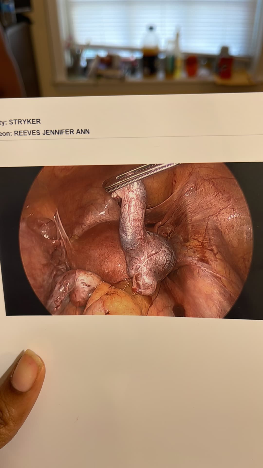 I had both tubes removed due to the negligence of the doctors I’m just trying to start my family, photo 1 of 1