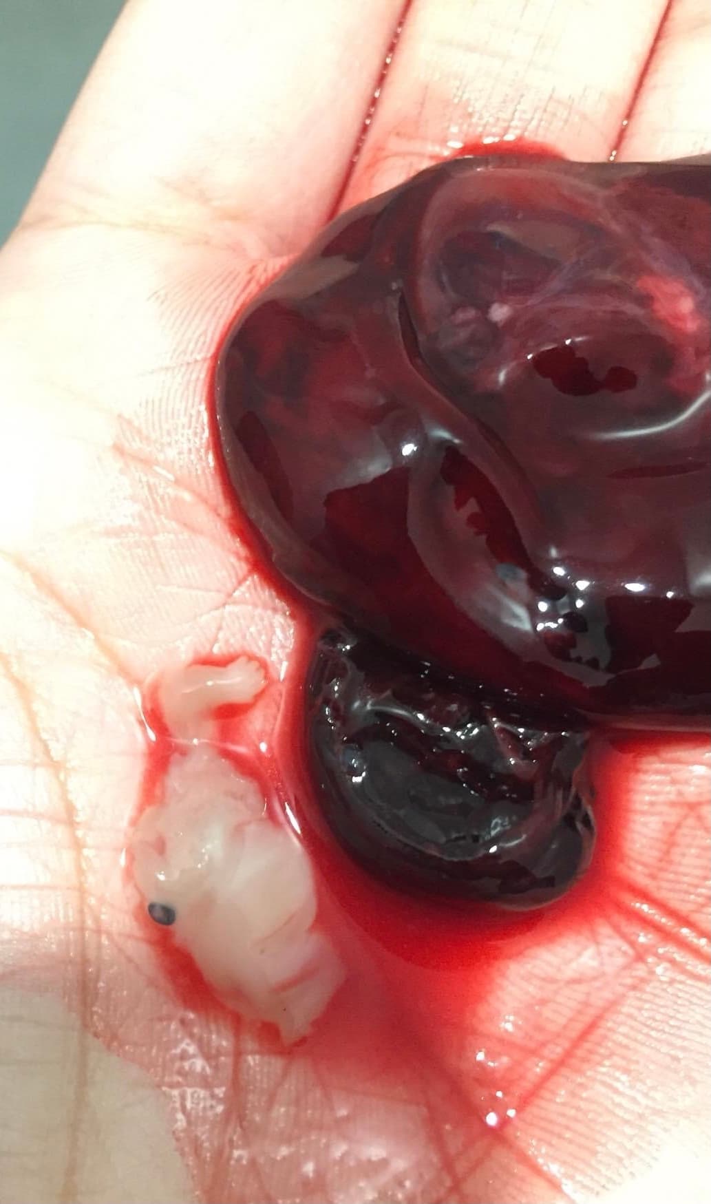 Ivf treatment, photo 1 of 1