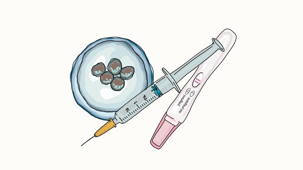 IVF treatment for Baby Legg, photo 1 of 1