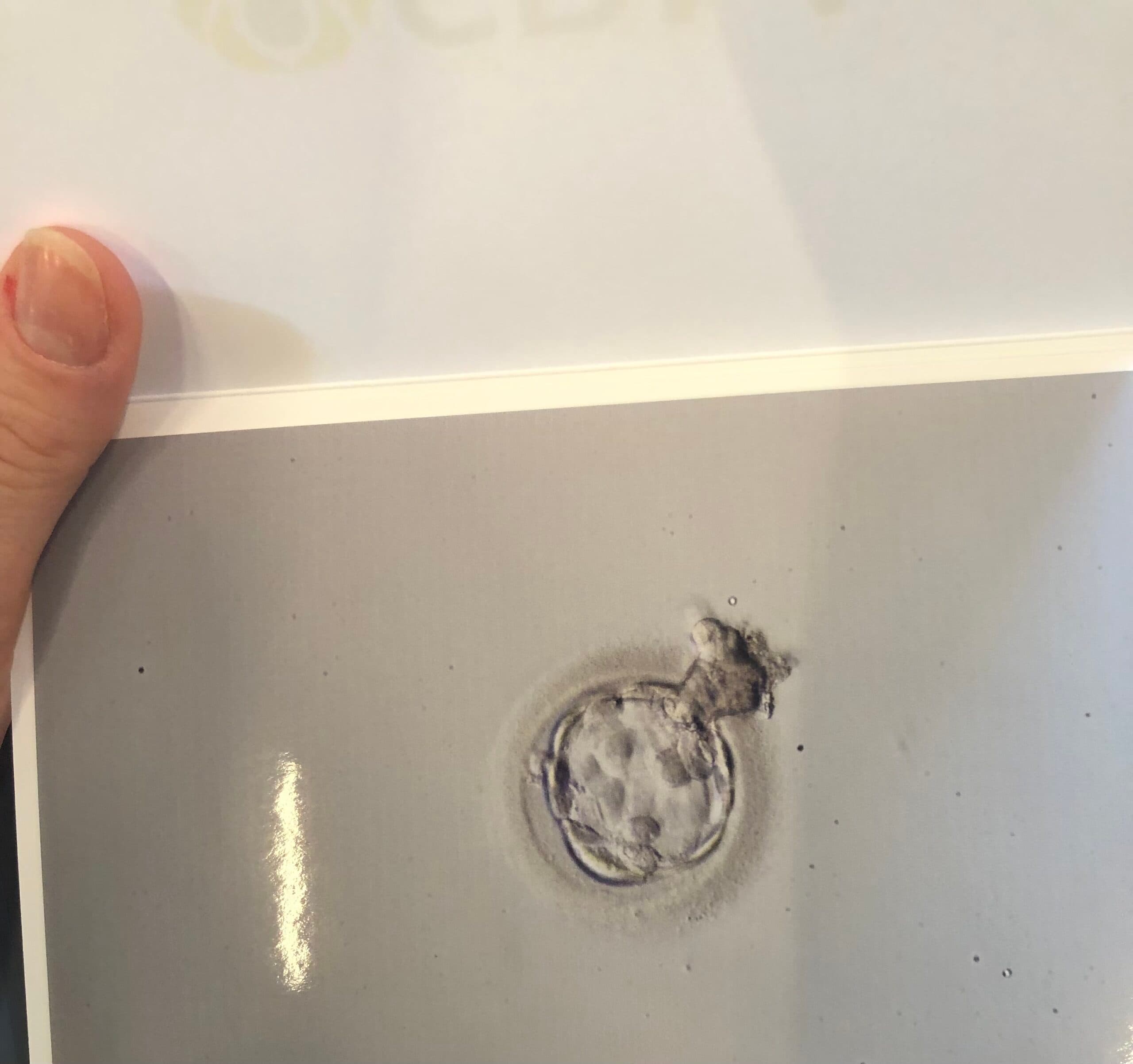 IVF, photo 1 of 1
