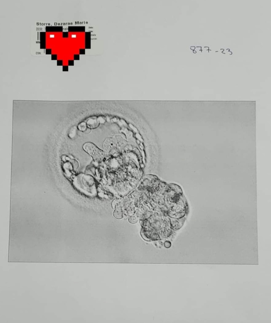 IVF Support for Baby Storrs, photo 1 of 5