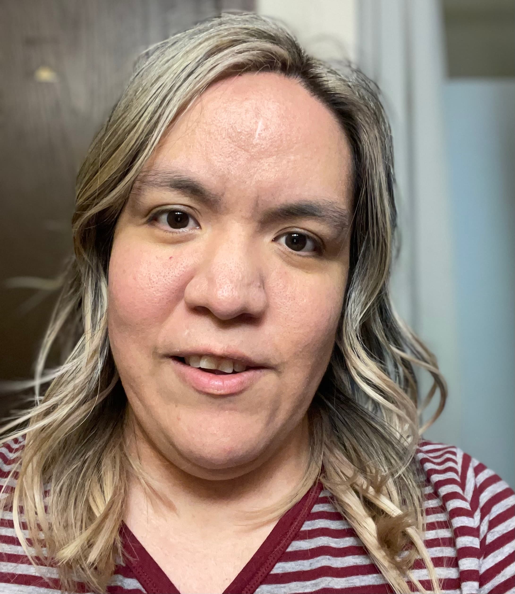 My IVF journey, photo 1 of 1