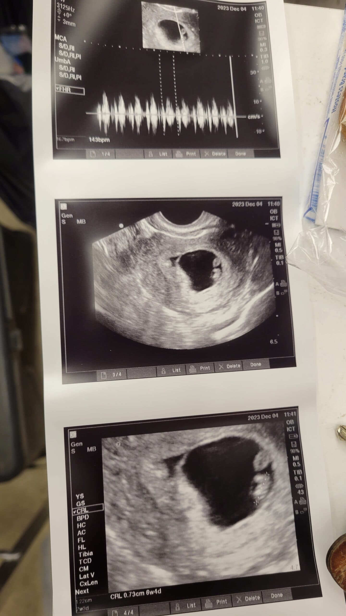 Ivf Treatment, photo 1 of 1