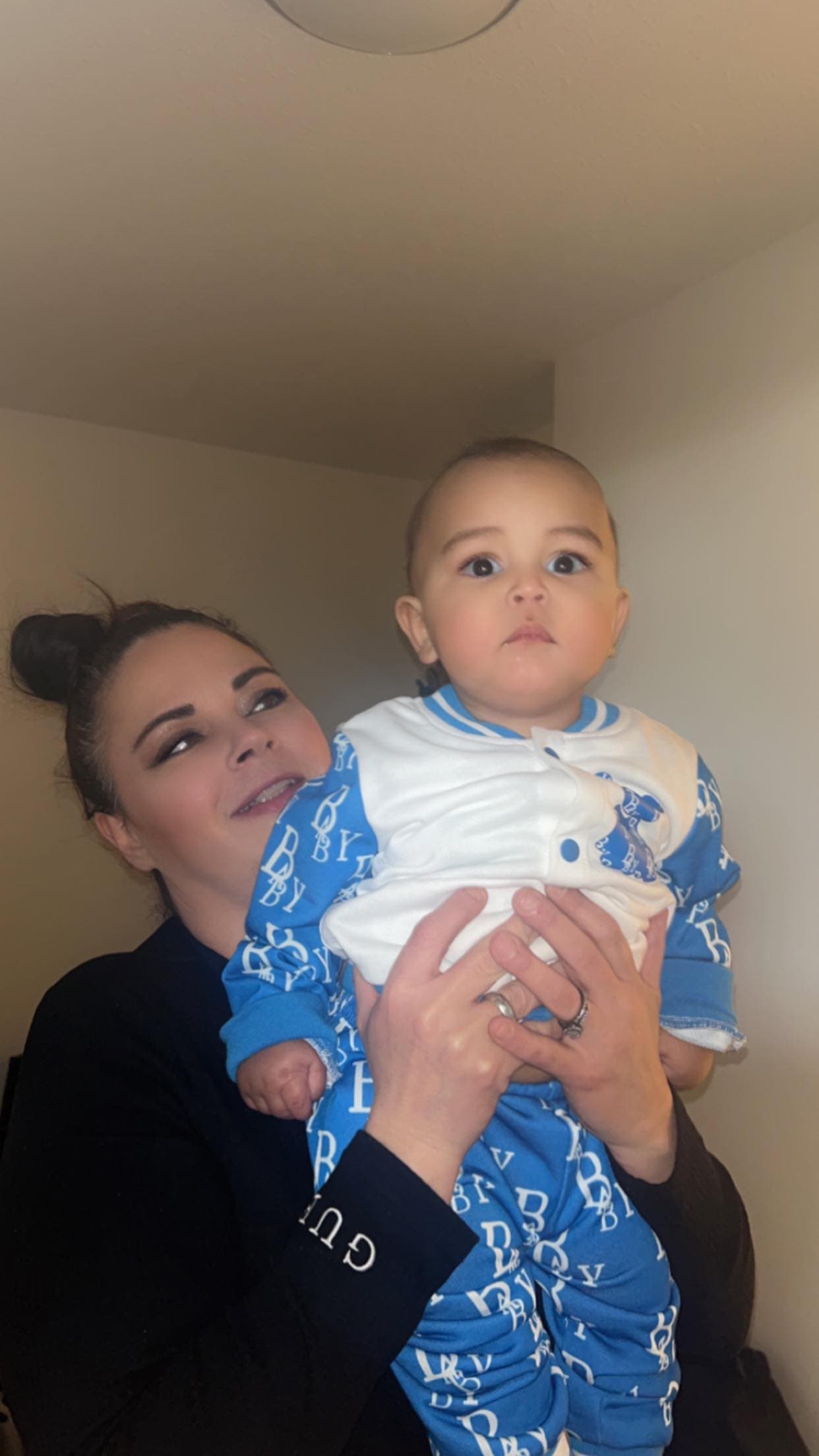 Tubal reversal, photo 1 of 2