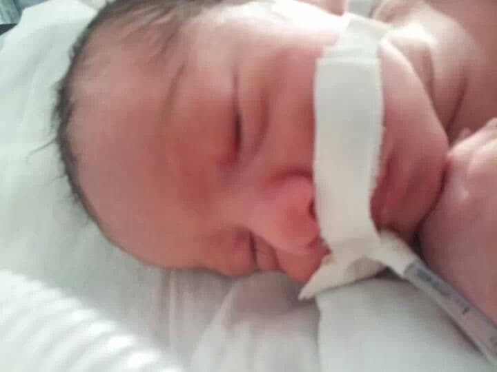 Tubal reversal, photo 1 of 5