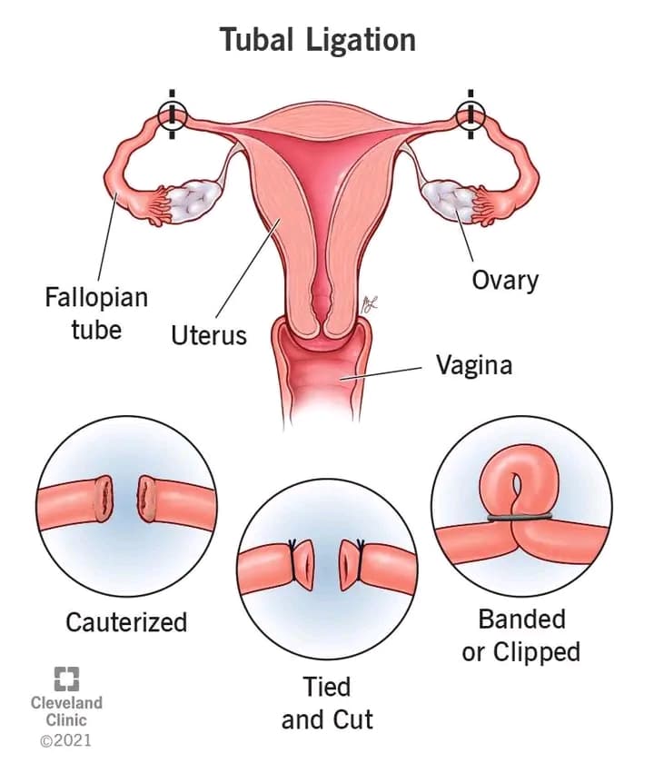 IVF journey, photo 1 of 1