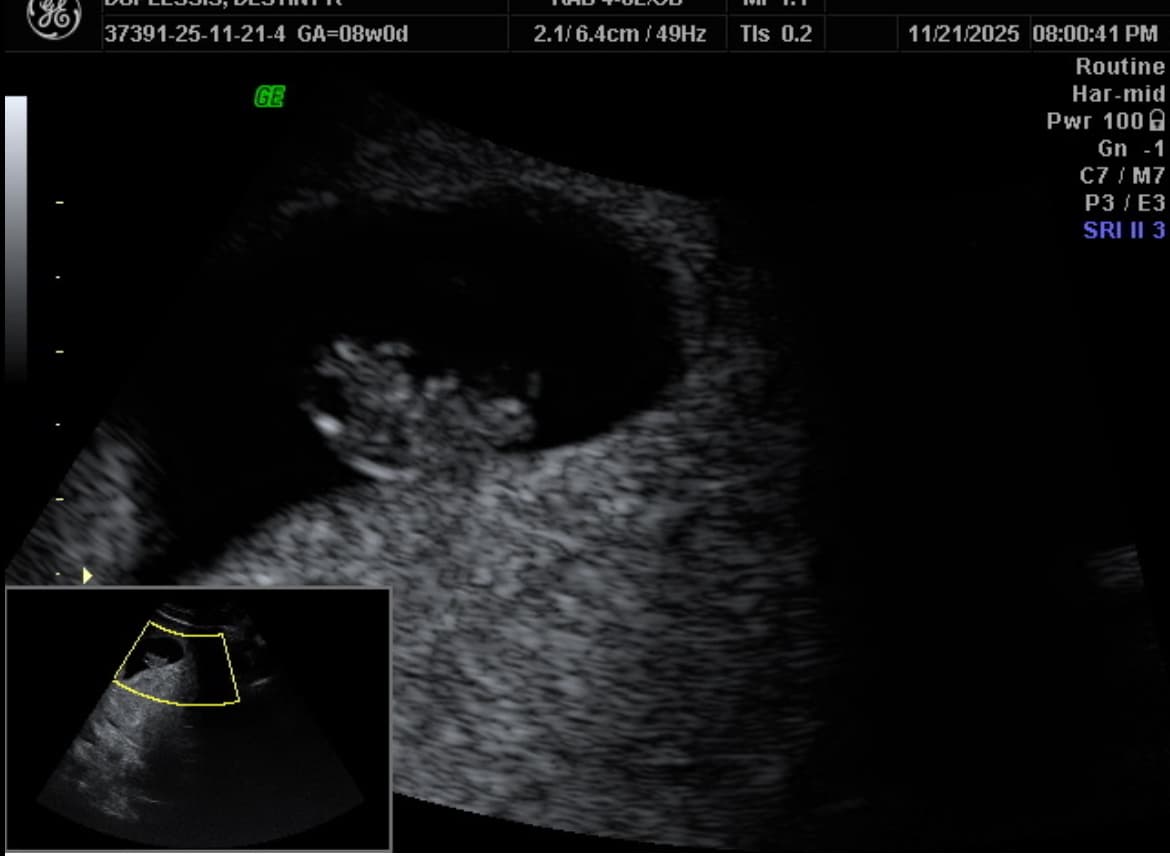 Safe Home for Des and Her Unborn Child, photo 1 of 1