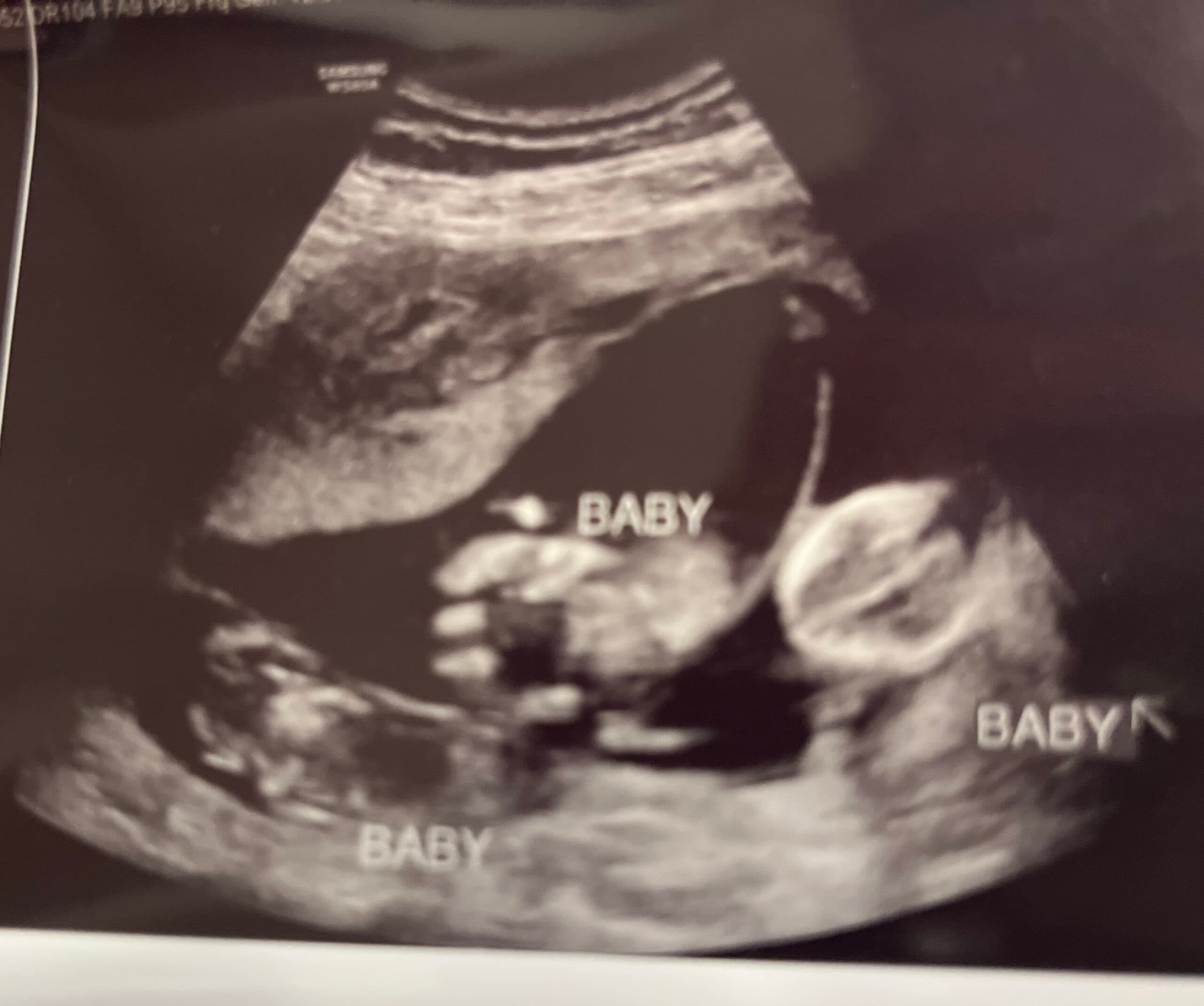 Surprise Triplets! Raising money help, photo 1 of 1