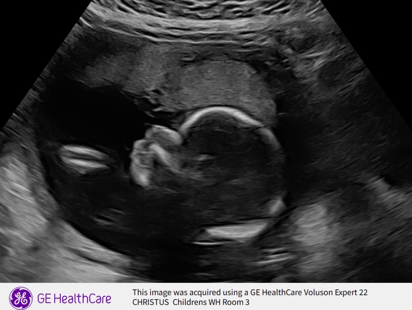 Baby Rozycki, photo 1 of 1